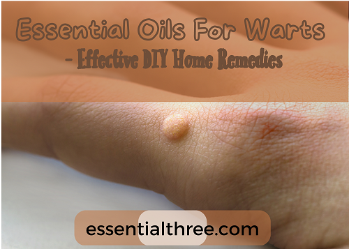 A number of studies have shown essential oils to be effective for wart removal.